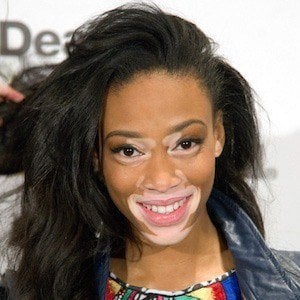 Winnie Harlow at age 20